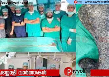 ഒരു മാസത്തിലേറെയായി വയറുവേദനയും ഛർദ്ദിയും;14 വയസുകാരിയുടെ വയറ്റിൽ നിന്ന് 210 സെന്റീമീറ്റർ നീളമുള്ള മുടിക്കെട്ട്