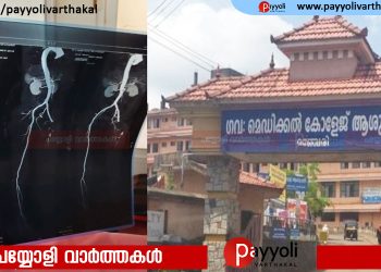കാല് വേദനയുമായി എത്തി; ശസ്ത്രക്രിയയിൽ രോഗിയുടെ കാലിന്റെ ഞരമ്പുകൾ മുറിച്ചു മാറ്റി, മഞ്ചേരി മെഡിക്കൽ കോളജിൽ ഗുരുതര ചികിത്സാ പിഴവ്