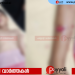 തച്ചൻ കുന്നിൽ വീണ്ടും തെരുവ് നായയുടെ വിളയാട്ടം: വിദ്യാർഥിയടക്കം മൂന്നു പേർക്ക് കൂടി കടിയേറ്റു, പ്രദേശത്ത് ഭീതി പടരുന്നു