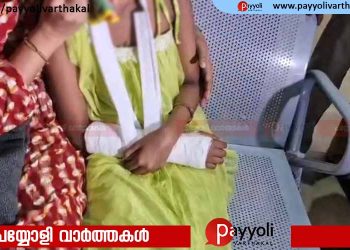 അഞ്ചാം ക്ലാസുകാരിയുടെ കൈ അധ്യാപകൻ തല്ലിയൊടിച്ചതായി പരാതി