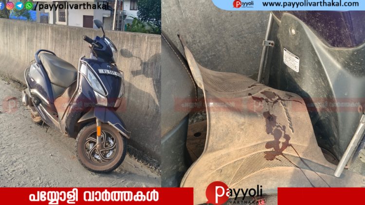 തിക്കോടിയിൽ വാഹനാപകടം: പയ്യോളി സ്വദേശിക്ക് ഗുരുതര പരുക്ക്