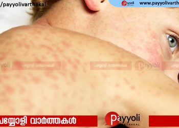 പ്രൈമറി സ്‌കൂള്‍ വിദ്യാര്‍ത്ഥികള്‍ക്ക് അഞ്ചാംപനി, കോഴിക്കോട് ജില്ലയിൽ രോഗപ്രതിരോധ പ്രവര്‍ത്തനങ്ങള്‍ ഊര്‍ജ്ജിതമാക്കി