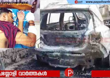 വീട്ടുപരിസരത്ത് അപരിചിതർ; ആരാണെന്ന് ചോദിച്ച യുവാവിനെ വെട്ടി, കാർ കത്തിച്ചു