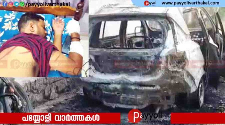 വീട്ടുപരിസരത്ത് അപരിചിതർ; ആരാണെന്ന് ചോദിച്ച യുവാവിനെ വെട്ടി, കാർ കത്തിച്ചു